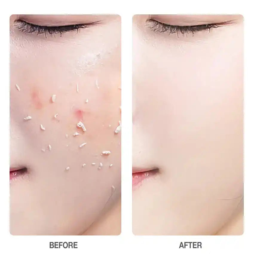 XQM 2-in-1 Face & Body Scrub Gel ( BUY 1 GET 1 FREE )